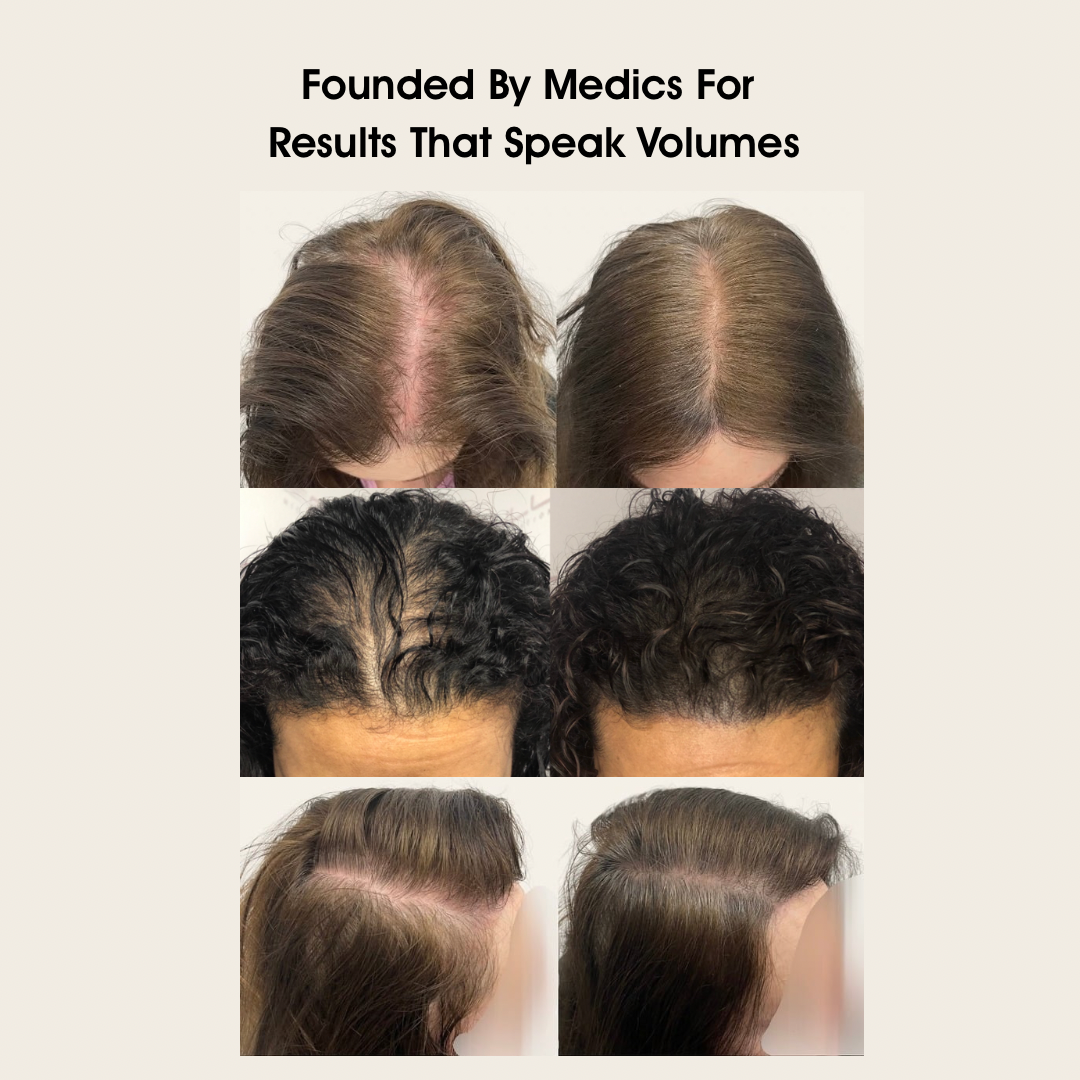 Intense Growth Boost Serum | 90 Day Growth Challenge