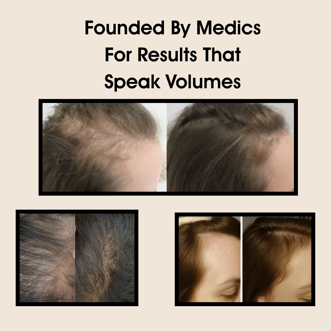 Hair Wand &amp; Hair Shot Bundle- 3 Months Supply For Twice Weekly Use