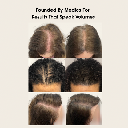 Intense Growth Boost Serum | 60 Day Growth Challenge